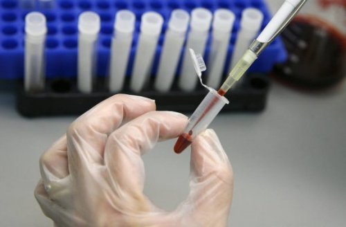 Stamcelletransplantation kunne udrydde hiv