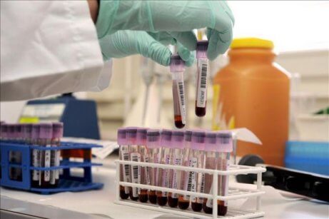 Blodprøver som del af at udrydde HIV