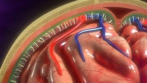 Infusionspumpe: Anvendelse og patientpleje