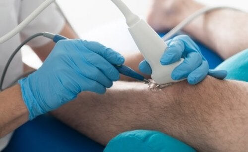 Læge opererer i knæ pga. gigt