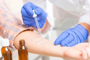 Typer af allergitest: Procedurer
