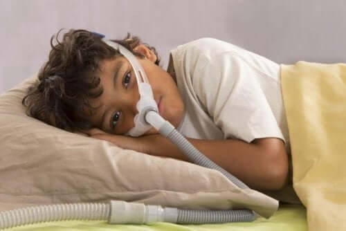 Obstruktiv søvnapnø hos børn bør opdages