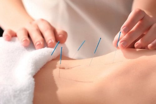 En af de største fordele ved akupunktur er, at det hjælper med at reducere smerter. Det kan hjælpe med at reducere enhver form for smerte, herunder menstruationssmerter, migrænesmerter eller smerter på grund af dårligt blodomløb