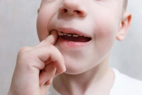 Dreng med rådne tænder