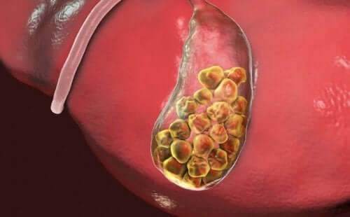 Selvom den er lille, spiller galdeblæren en vigtig rolle i kroppens sunde funktion. Dets vigtigste funktion er opbevaring af galden, en væske, der er nødvendig for fordøjelsen