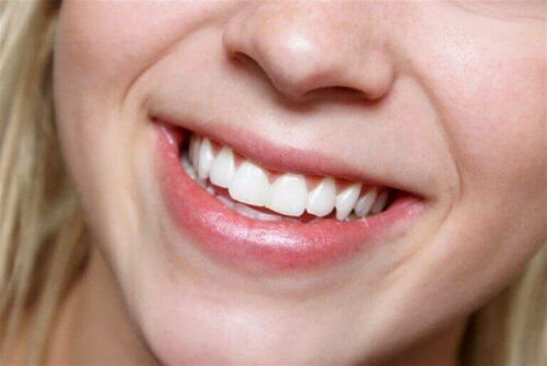Kvinde med hvide tænder