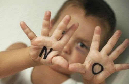 Dreng med blåt øje og teksten "NO" på sinde hænder
