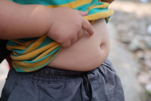 Overvægt i barndommen: Et stort problem