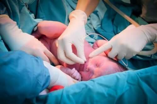 Perinatal asfyksi betragtes som en af de største årsager til neonatale dødsfald, hvilket illustreres af nyfødt, der får ilt gennem slande