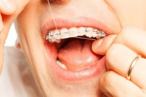 Tandtråd er en vigtig del af god mundhygiejne med tandregulering