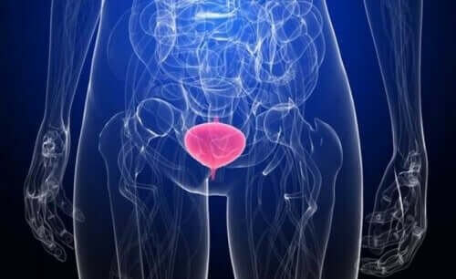 Illustration af menneskekrop med blærebetændelse 