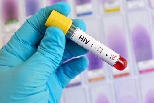 Positiv HIV-blodprøve