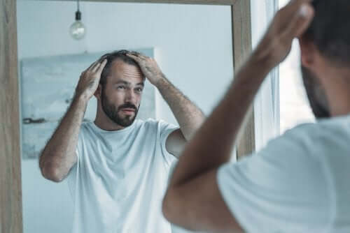 Mand med alopecia