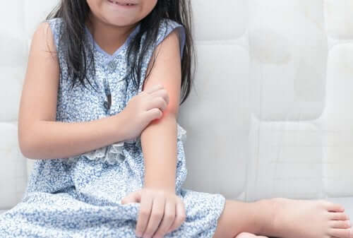 Psoriasis hos børn: Sådan håndterer du det