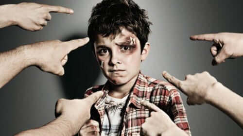 Dreng med mærker i hovedet og fingre pegende mod sig illustrerer børnemobning