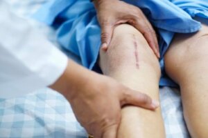 Heling efter en knætransplantation