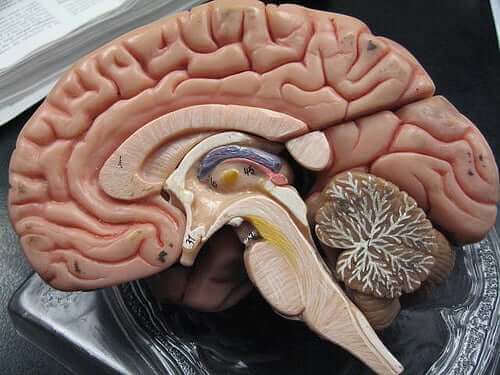 Illustration af hjerne med subarachnoid og subdural blødninger