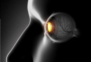 Skeløjethed: Symptomer og behandlinger