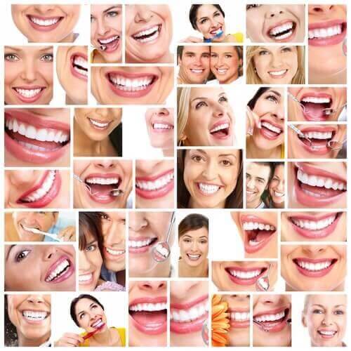 Billeder af hvide tænder som resultat af at bruge mundskyl