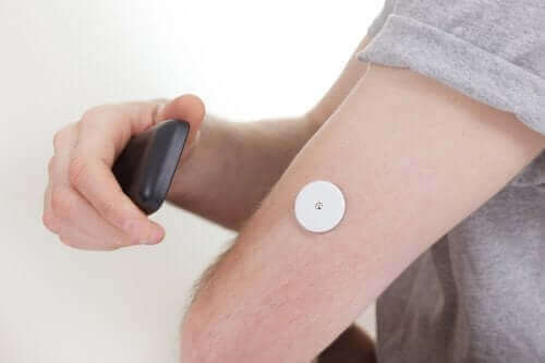 Du kan få information i realtid om dit blodsukker med et implanteret overvågningsapparatur til glukosemonitorering