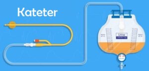 Behandling af urinretention efter fødsel