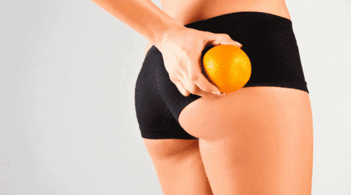 Kvinde med appelsin ved bagdelen symboliserer forebyggelse af cellulitis