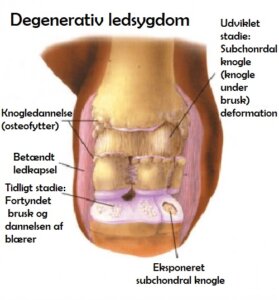 Degenerativ ledsygdom: Årsager og behandling