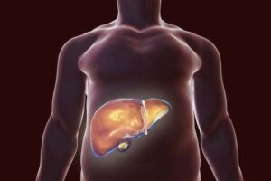 Sund galdeblære: Tips til den rette kost