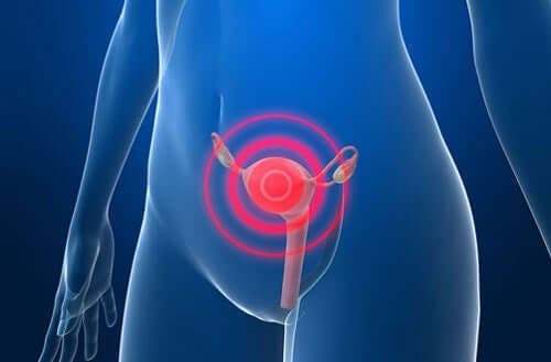 Illustration af kvindes underliv