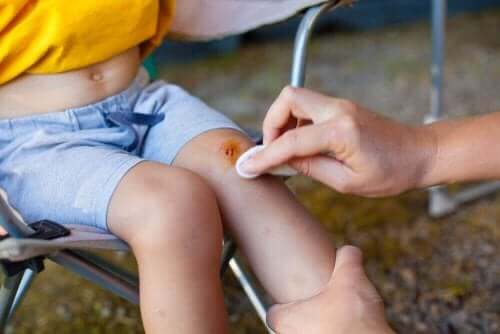 Voksen renser sår på barn knæ
