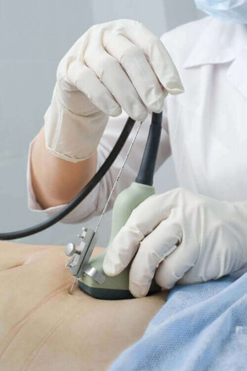 Læge tjekker underliv med ultralyd