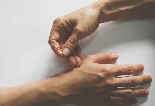 Akupunktur i hånd til at behandler ledsmerter