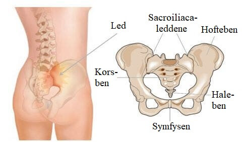 Illustration af hypermobilitet i SI-leddene
