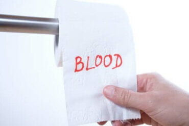 opstrøms kun Typisk Blod i afføringen: Hvorfor sker det? - Bedre Livsstil