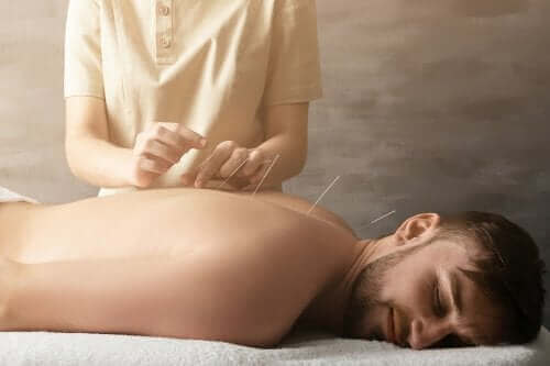 Akupunktur til at behandle ledsmerter