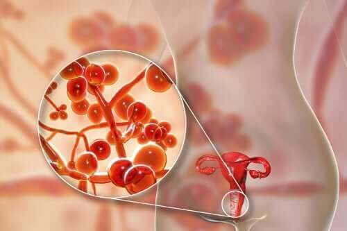 Mycoplasma genitalium: Årsager, symptomer og behandling