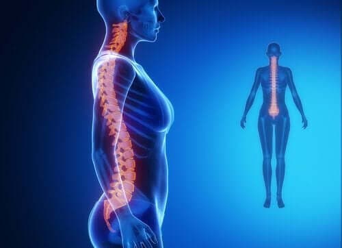 Diagnose og behandling af slidgigt i ryggen