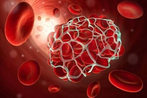 Lavdosis aspirin hjælper med at gøre blodet mere flydende og forhindrer, at disse blodpropper dannes og udløser hjerteanfald, som illustreret af disse blodlegemer i et net