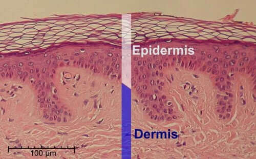 Epidermis og dermis