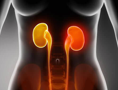 Nyresvigt er den førende årsag til hyperfosfatæmi