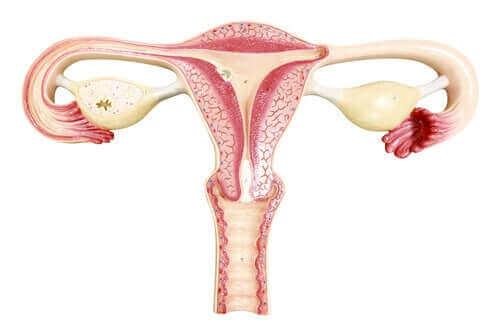 Kvindelig sterilisation hindrer og stopper strømmen af ​​sæd til ægget