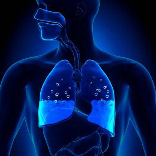Lungeødem: Symptomer og årsager