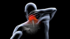 Forebyggelse og behandling af muskelkontrakturer