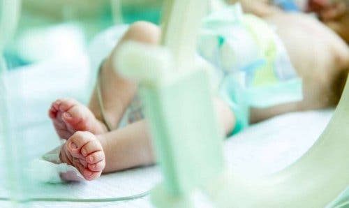 Baby med gastroschise