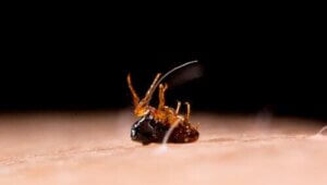 Tungiasis: Symptomer og behandling