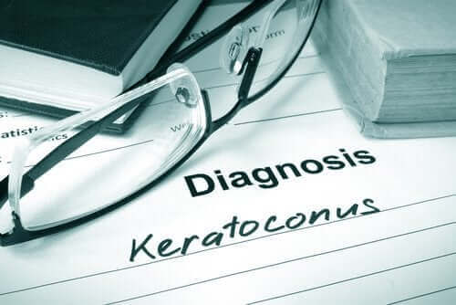Keratoconus - Karaktertræk og behandling