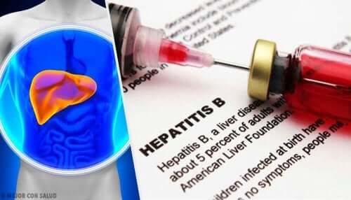 Hepatitis A, B og C er forårsaget af vira