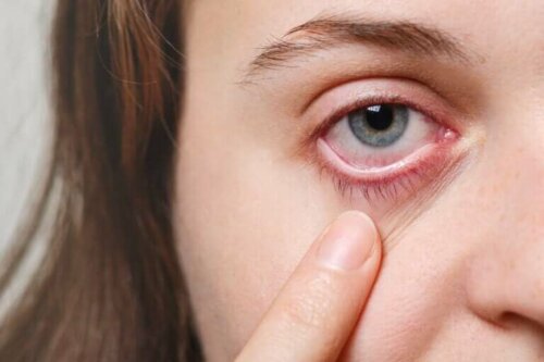 Øjenmigræne, også kaldet oftalmisk migræne, henviser til en tilstand, der manifesterer sig med en midlertidig og smertefri synsforstyrrelse.
