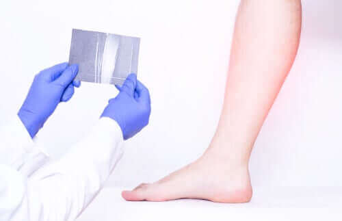 Læge tjekker for en persons lægmuskler