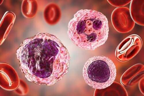 Høje niveauer af monocytter i blodet: Symptomer og behandlinger